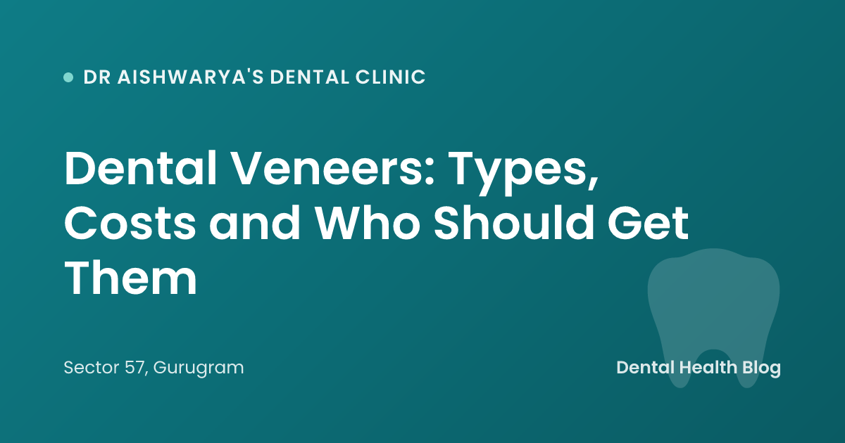 Dental Veneers: Types, Costs and Who Should Get Them