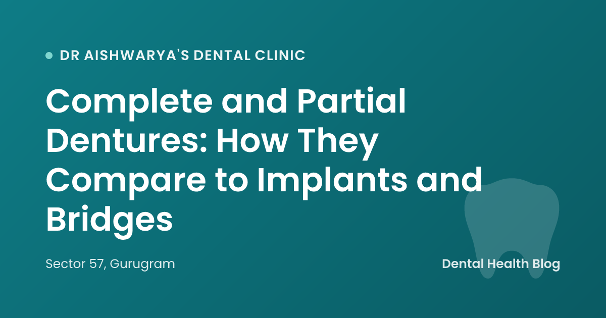 Complete and Partial Dentures: How They Compare to Implants and Bridges
