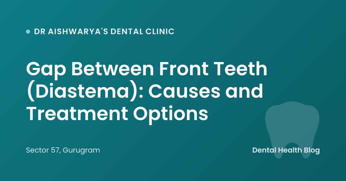 Gap Between Front Teeth (Diastema): Causes and Treatment Options