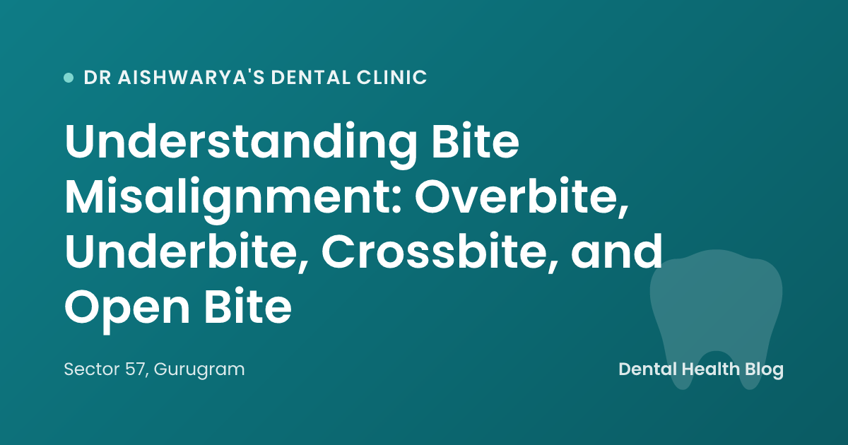 Understanding Bite Misalignment: Overbite, Underbite, Crossbite, and Open Bite