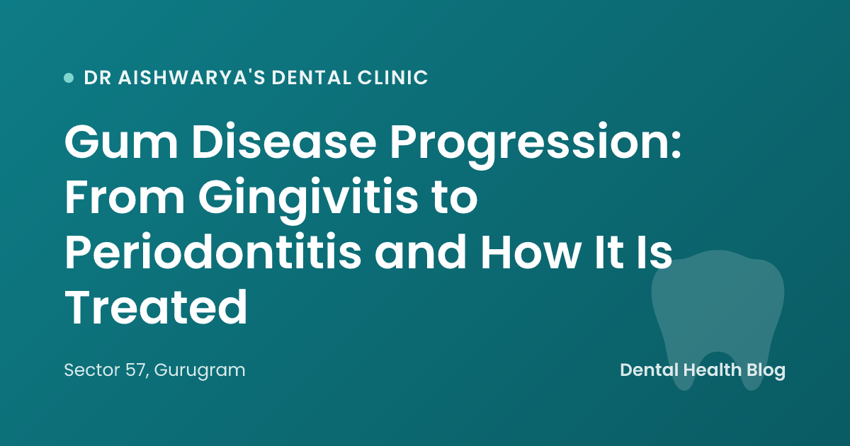 Gum Disease Progression: From Gingivitis to Periodontitis and How It Is Treated