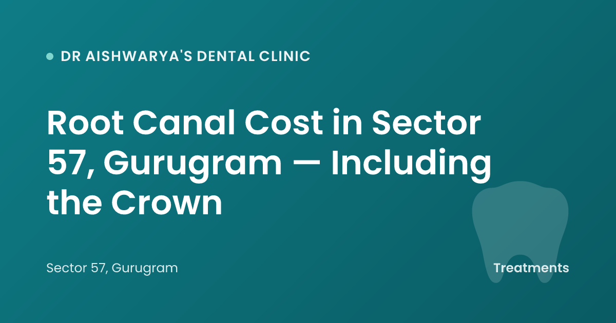 Root Canal Cost in Sector 57, Gurugram — Including the Crown